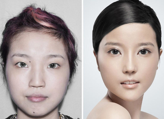Фото китаянок до и после пластики