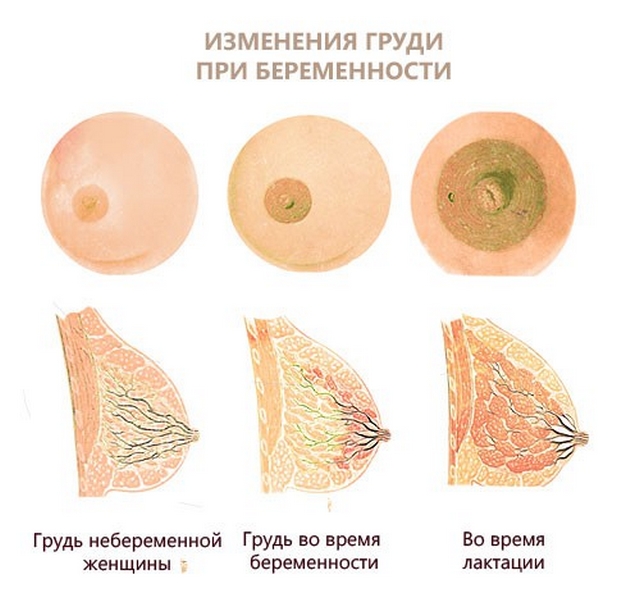Причины и лечение пигментации ореола вокруг сосков