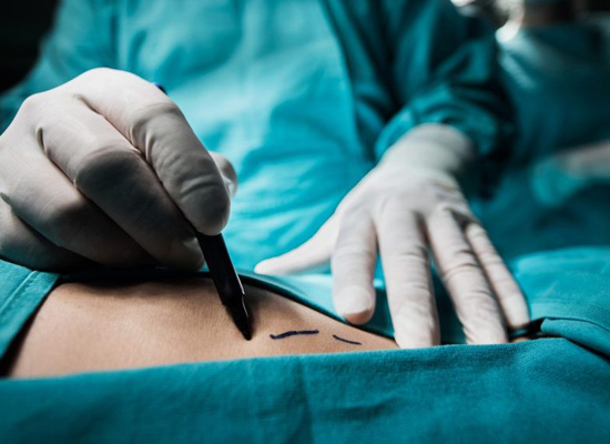Пациенткам пришлось ампутировать грудь из-за введенного хирургом вазелина